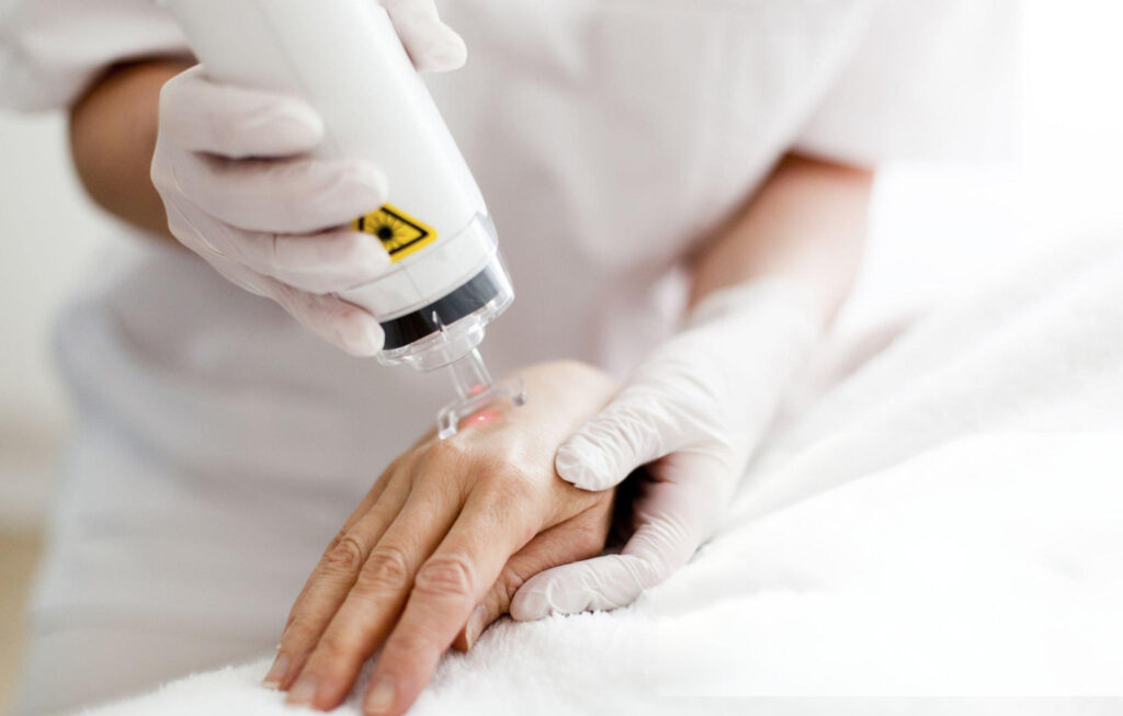 خطوات بعد جلسات الليزر